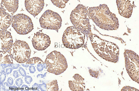 beta Tubulin Monoclonal Antibody B-IO-10032