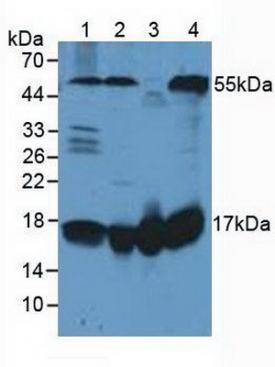 Polyclonal Antibody to Fission 1 (FIS1)B-IO-10211